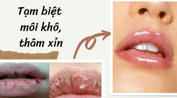 3 cách dưỡng môi căng mịn ngày đông ba cách dưỡng môi căng mịn ngày đông